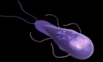 Какво да представляваме lamblias
