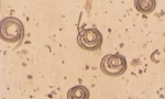 Какво е trichinella spiralis