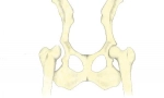 Дисплеи на тазобедрените стави при кучета: диагностика, лечение и прогнози