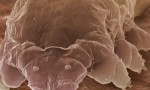 Mite demodex и характеристики на препитанието му