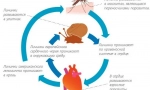 Сърдечни червеи