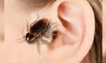 Тракакан в ухото: симптоми и екстракция
