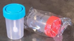 Анализ на яйцата на яйцето