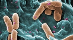 Какво се различават eukaryotes от prokaryot?