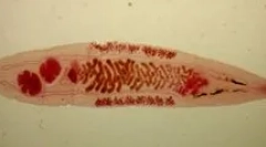 Какво представляват описторното