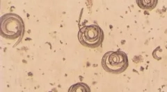 Какво е trichinella spiralis