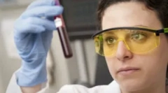 Как се извършва кръвен тест върху токсоплазмоза