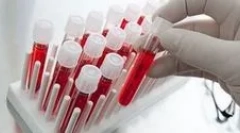 Какви кръвни изследвания на паразитите трябва да преминат?