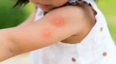 Топ инструменти от комари за деца