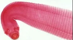 Най-често срещаните видове червеи при хора