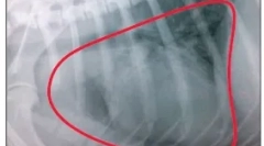 Белодробни тумори