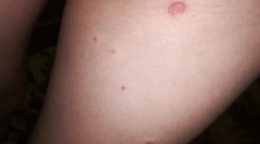 Защо някои хора хапят бълхи и няма други