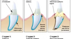 Homemade predator care - cattick почистване